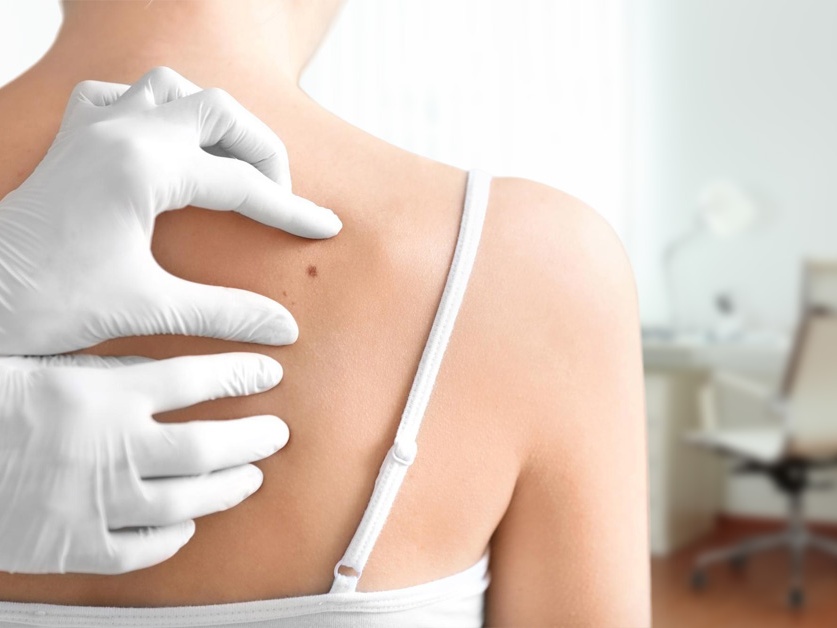 Kožní ambulance - MUDr. Vladimír Vacík